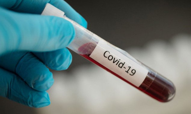 В Украине зафиксировано более 11 тысяч новых носителей коронавирусной болезни