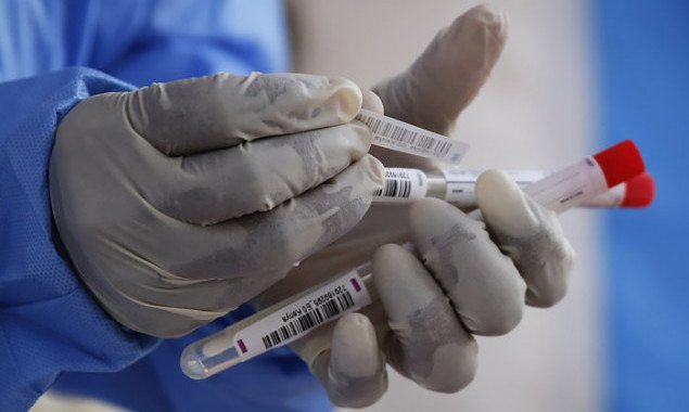 В Украине зафиксировано более 5 тысяч новых носителей коронавирусной болезни