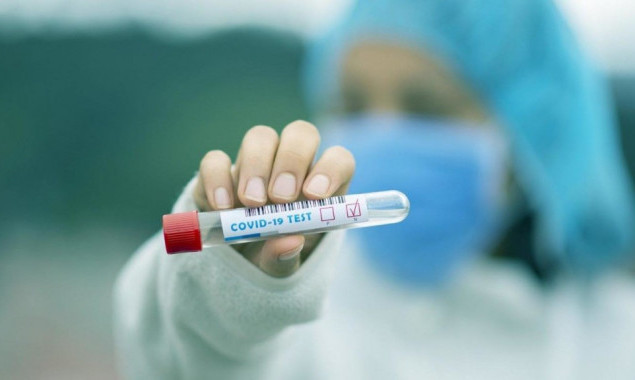 За останню добу на коронавірус захворіли 433 жителя Київщини